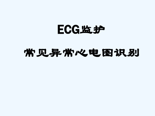 ECG监护及常见异常心电图的识别