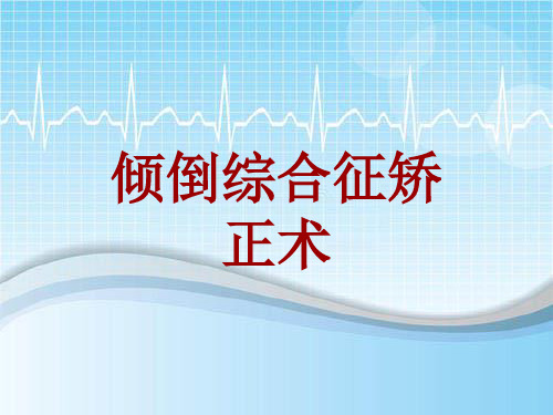 手术讲解模板:倾倒综合征矫正术
