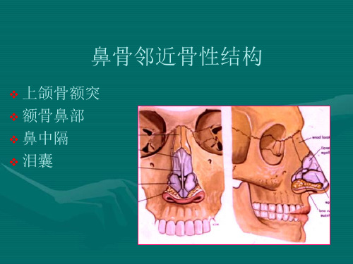 鼻骨骨折影像学诊断