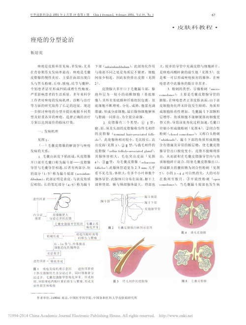 痤疮的分型论治