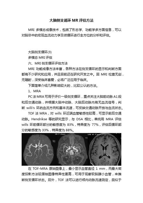 大脑侧支循环MR评估方法