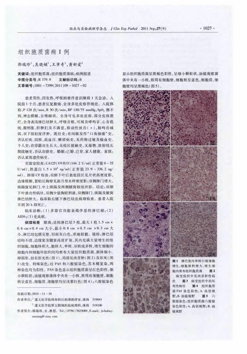 组织胞质菌病1例