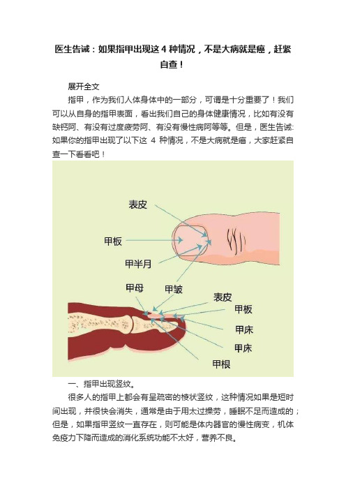 医生告诫：如果指甲出现这4种情况，不是大病就是癌，赶紧自查！