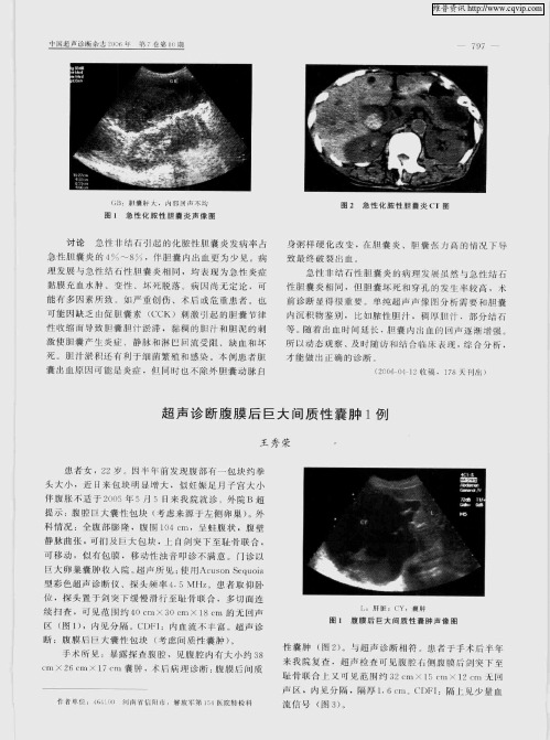 超声诊断腹膜后巨大间质性囊肿1例