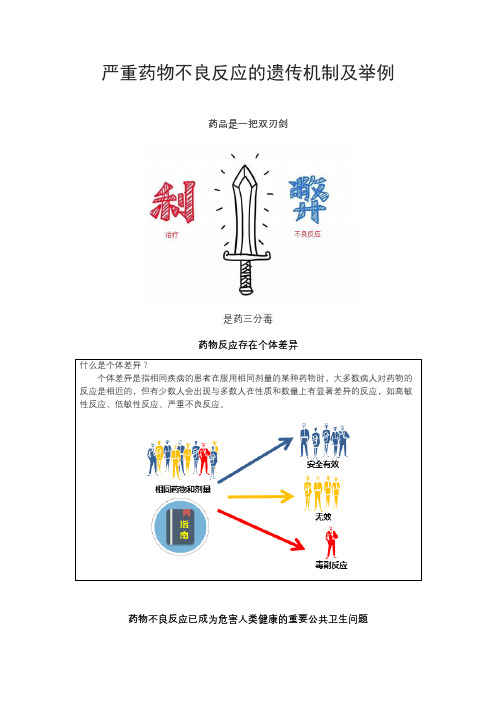 严重药物不良反应的遗传机制及举例