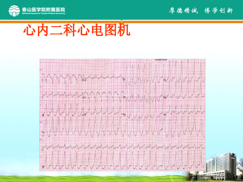 心内科常用检查及注意事项培训课件