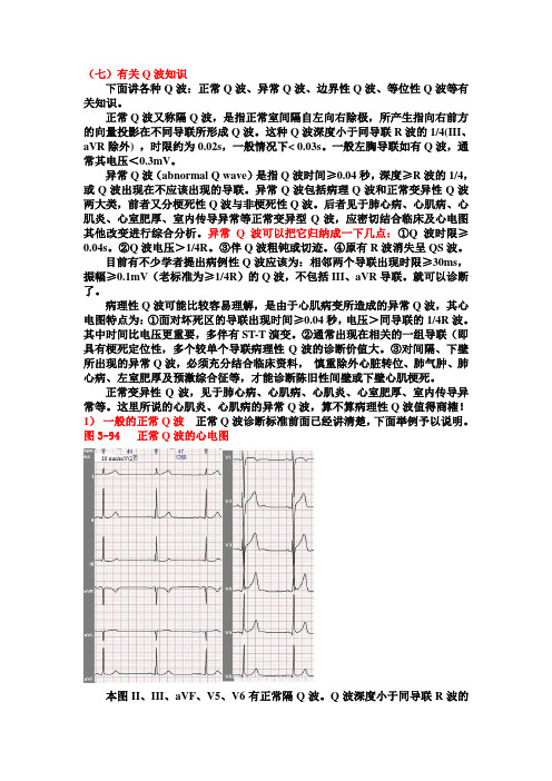 另类心电图学讲义8--有关Q波知识