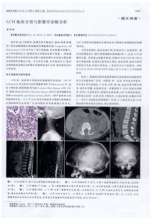 LCH临床分型与影像学诊断分析