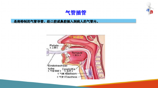 常用急救技术—气管插管术(护理课件)