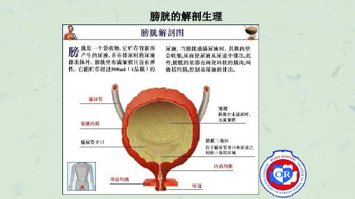 膀胱癌手术配合ppt课件