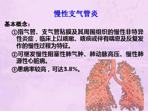 慢支肺气肿肺心病ppt课件