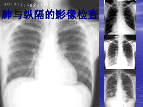 教你如何看肺部CTppt课件