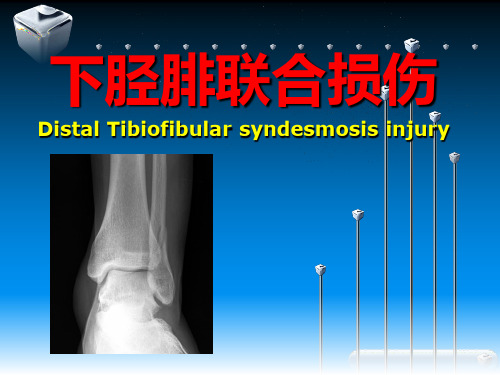 下胫腓联合损伤