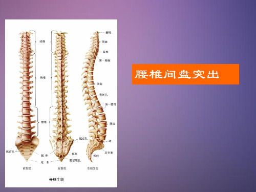 腰椎间盘突出症