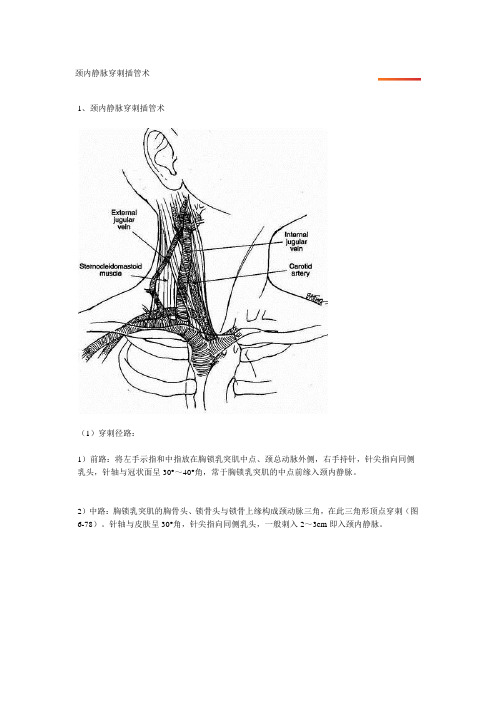 颈内静脉穿刺插管术