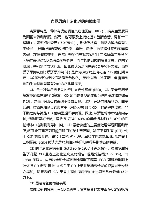 克罗恩病上消化道的内镜表现