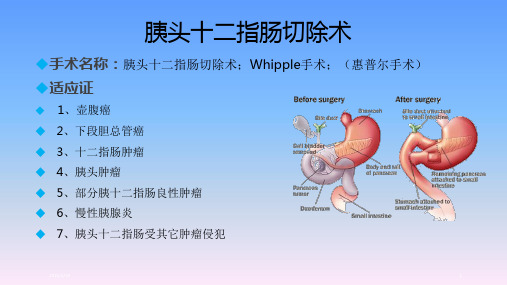 胰腺、十二指肠手术麻醉ABC