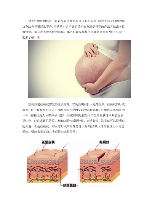 妊娠纹修复的主要原理是什么呢？