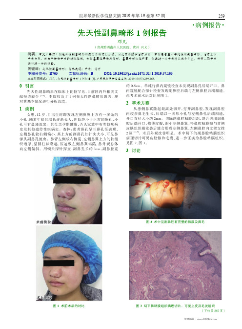 先天性副鼻畸形1例报告