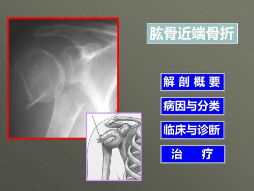 肱骨近端骨折ppt精品医学课件