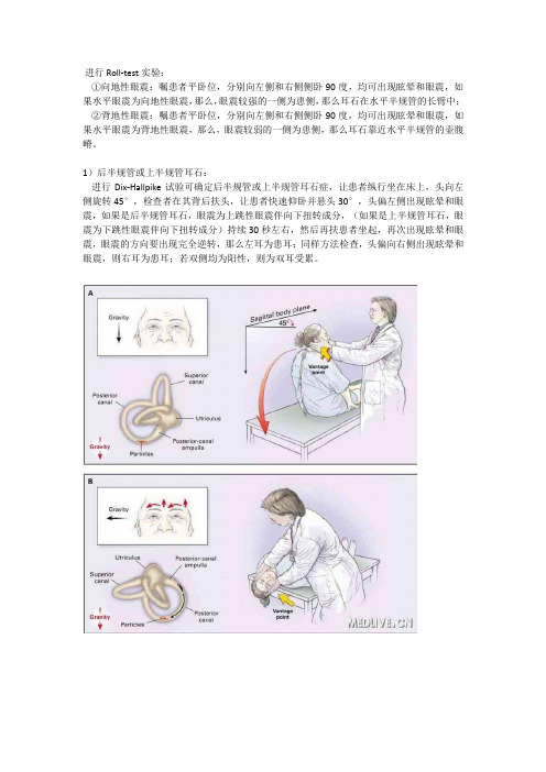 (完整)耳石症检测实验及复位手法大全,推荐文档