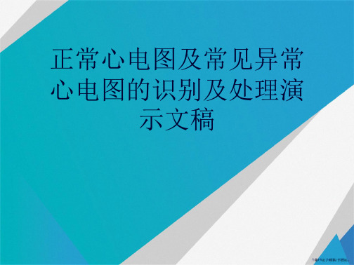 正常心电图及常见异常心电图的识别及处理演示文稿