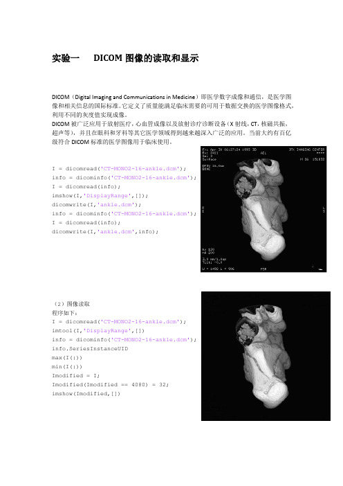 医学成像原理实验报告