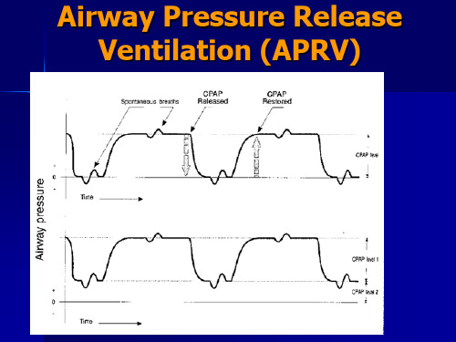 AirwayPressureReleaseVentilation-RespiratoryTherapy：气道压力释放通气呼吸疗法