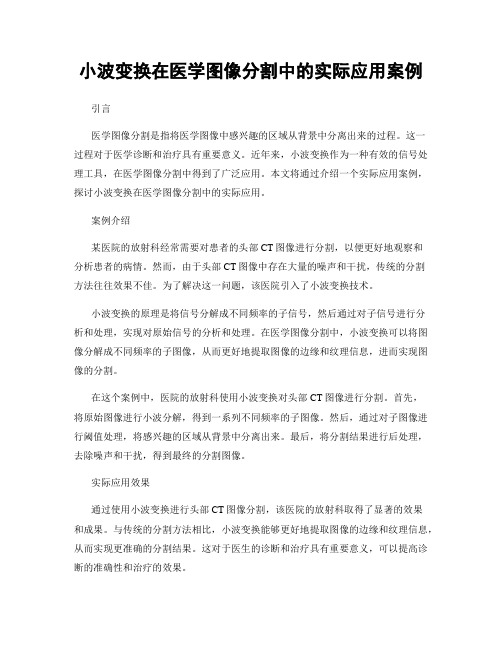 小波变换在医学图像分割中的实际应用案例