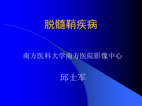 9脱髓鞘疾病-精选文档36页