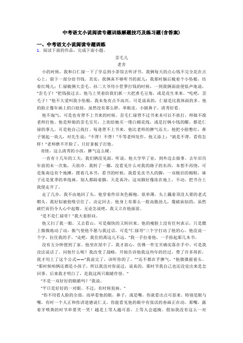 中考语文小说阅读专题训练解题技巧及练习题(含答案)