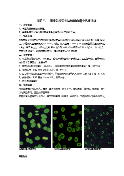 间接免疫荧光法检测血清中抗核抗体 临床免疫学