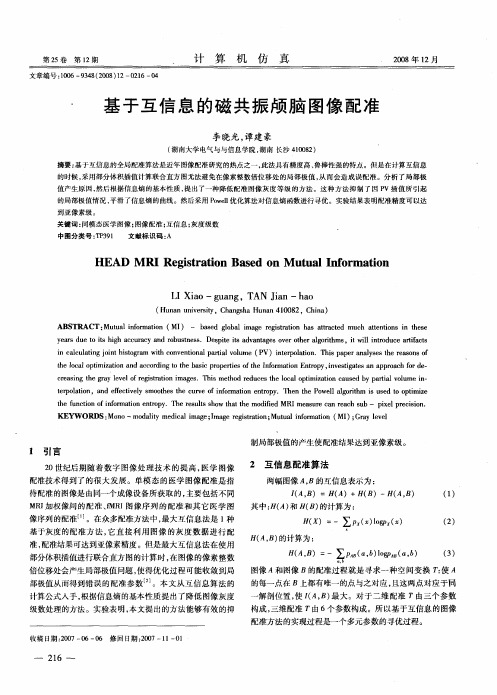 基于互信息的磁共振颅脑图像配准