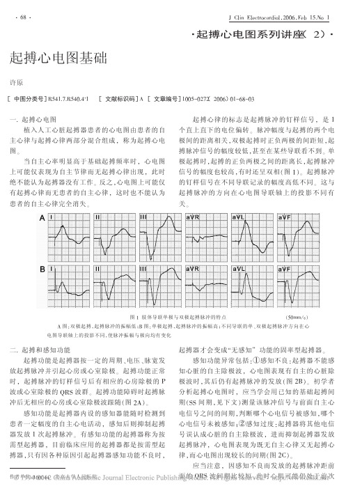 起搏心电图基础