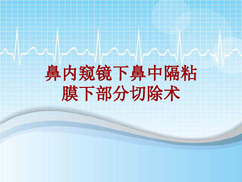 手术讲解模板：鼻内窥镜下鼻中隔粘膜下部分切除术