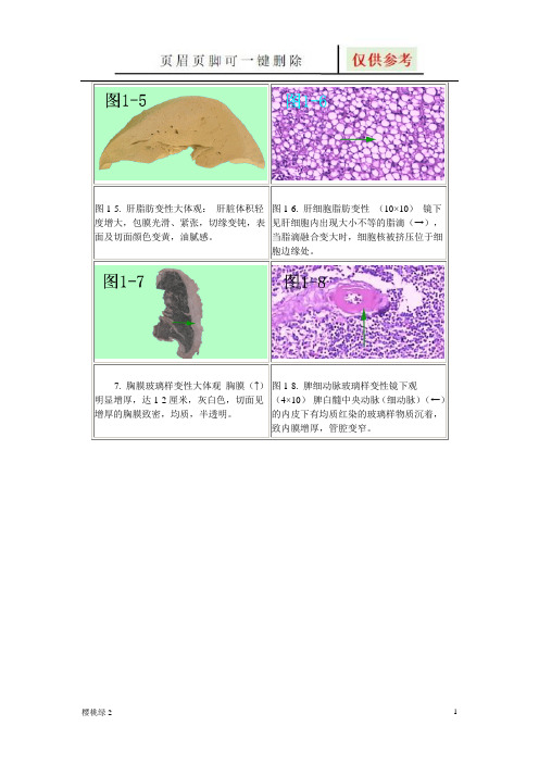 病理切片附图含化脓性炎等(相关知识)