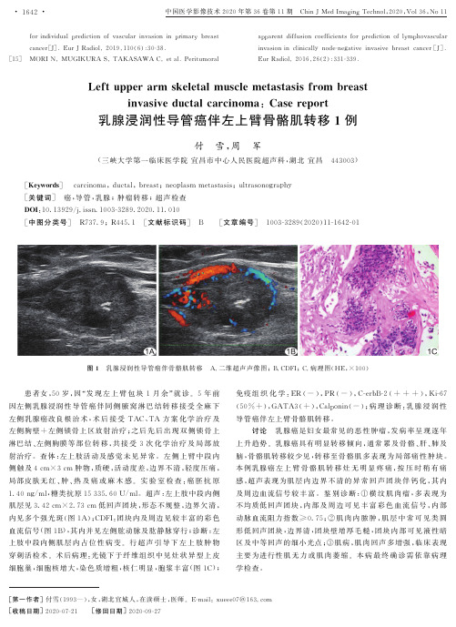 乳腺浸润性导管癌伴左上臂骨骼肌转移1例