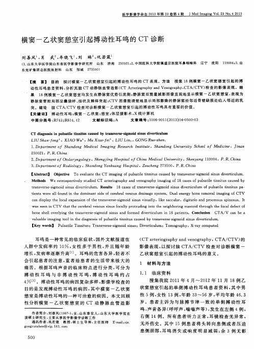 横窦-乙状窦憩室引起搏动性耳鸣的CT诊断