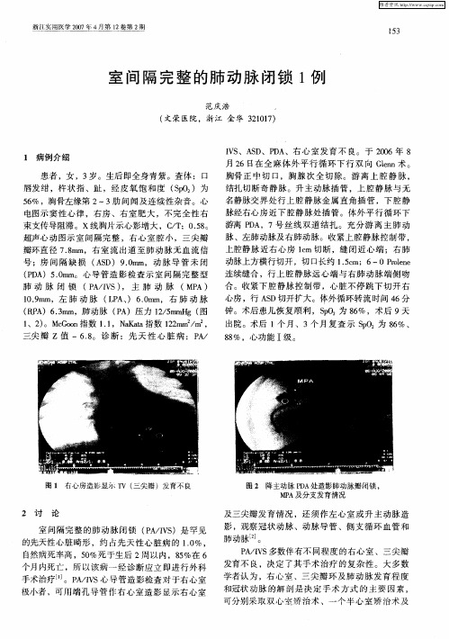 室间隔完整的肺动脉闭锁1例