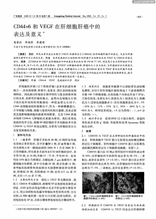 CD44v6和VEGF在肝细胞肝癌中的表达及意义