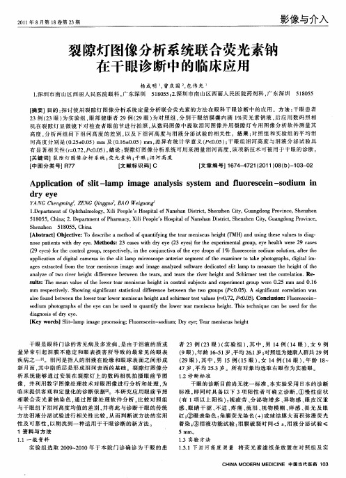 裂隙灯图像分析系统联合荧光素钠在干眼诊断中的临床应用