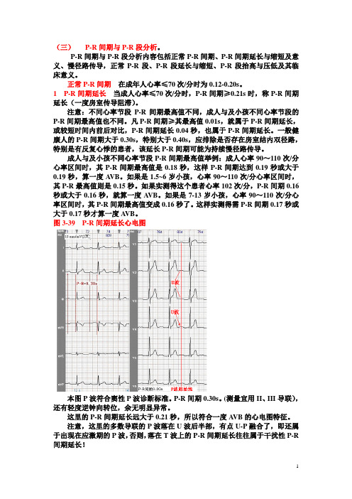 另类心电图学讲义5--P-R段与P-R间期资料