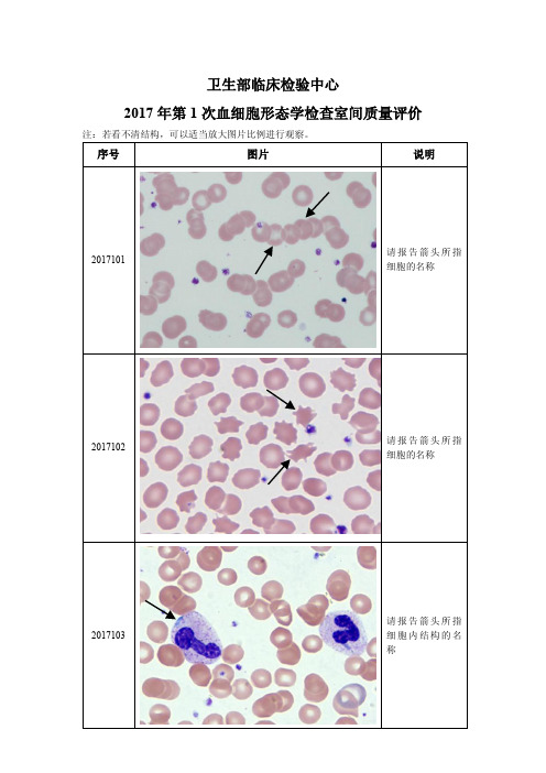 2017年卫生部血细胞形态学检查室间质量评价
