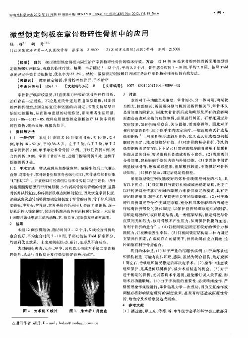 微型锁定钢板在掌骨粉碎性骨折中的应用