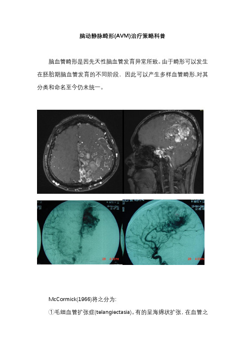 脑动静脉畸形(AVM)治疗策略科普