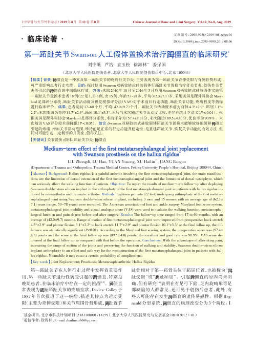 第一跖趾关节swanson人工假体置换术治疗■僵直的临床研究