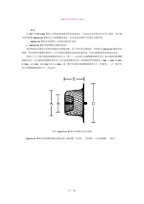 动脉导管未闭伞堵术