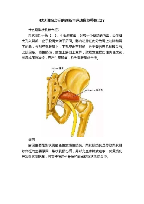 梨状肌综合征的诊断与运动康复整体治疗