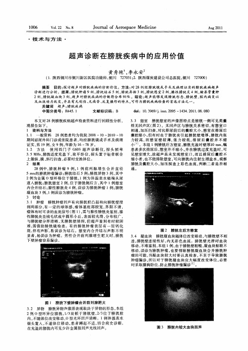 超声诊断在膀胱疾病中的应用价值