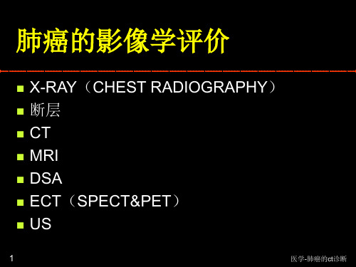 医学-肺癌的ct诊断课件